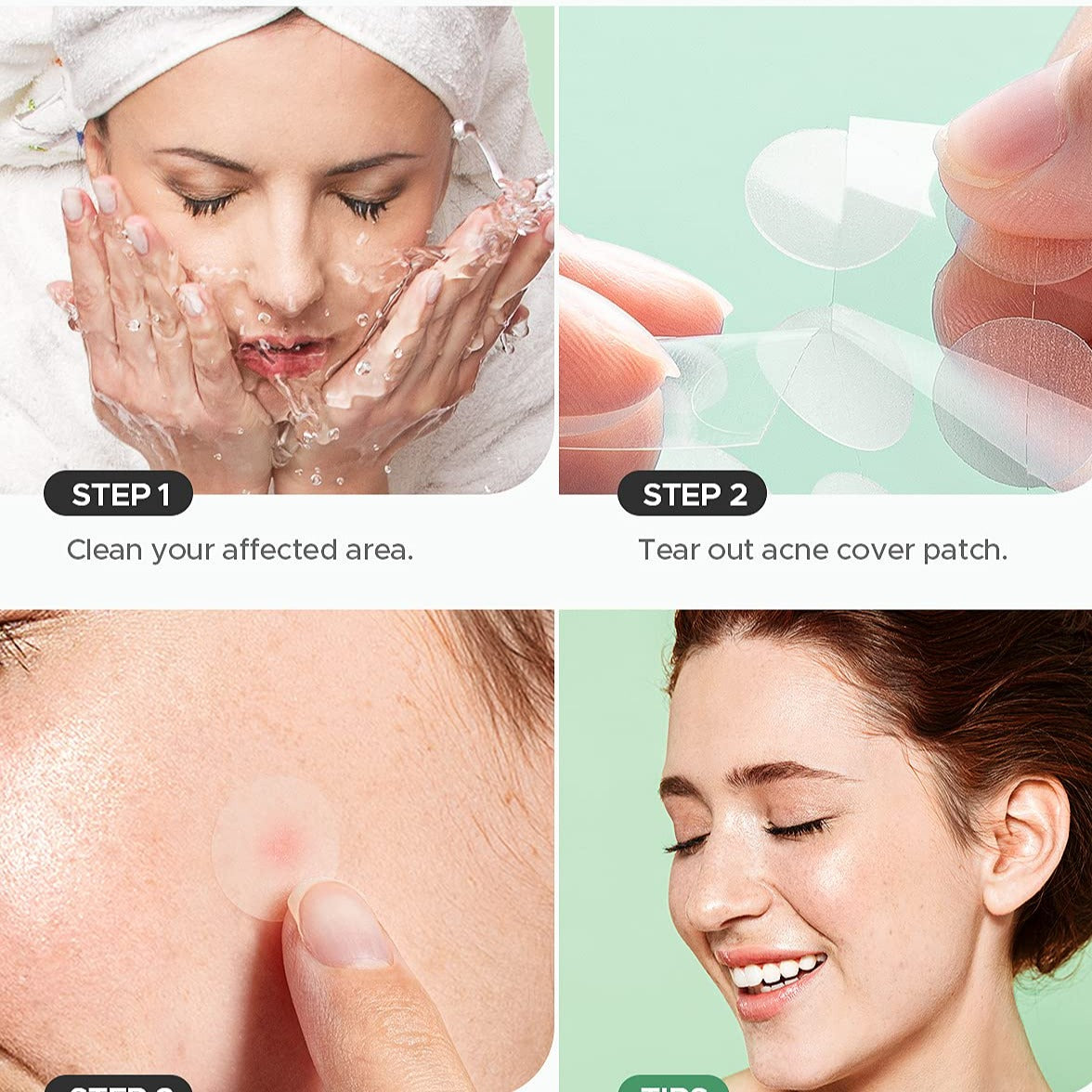 24 Patches To Eliminate Acne 