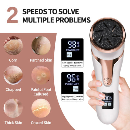 Electric Callus Remover for Feet + Free Shipping 