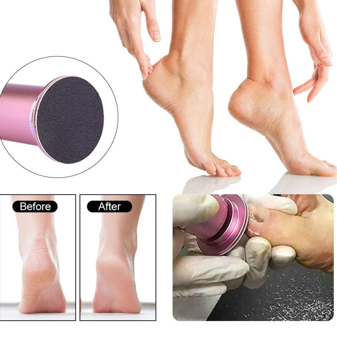 Electric Callus Remover with Sandpaper + Free Shipping 