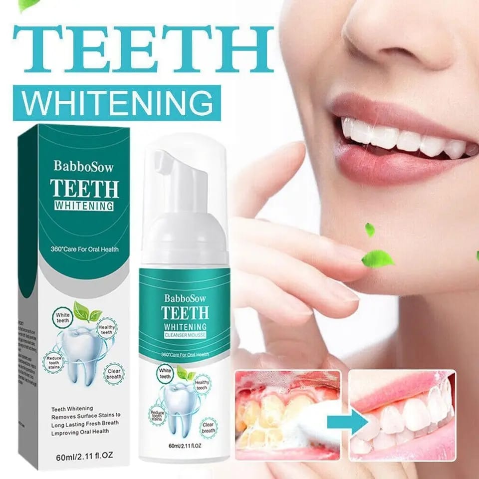 Teeth Whitening Foam + Free Shipping 