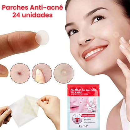 24 Patches To Eliminate Acne 