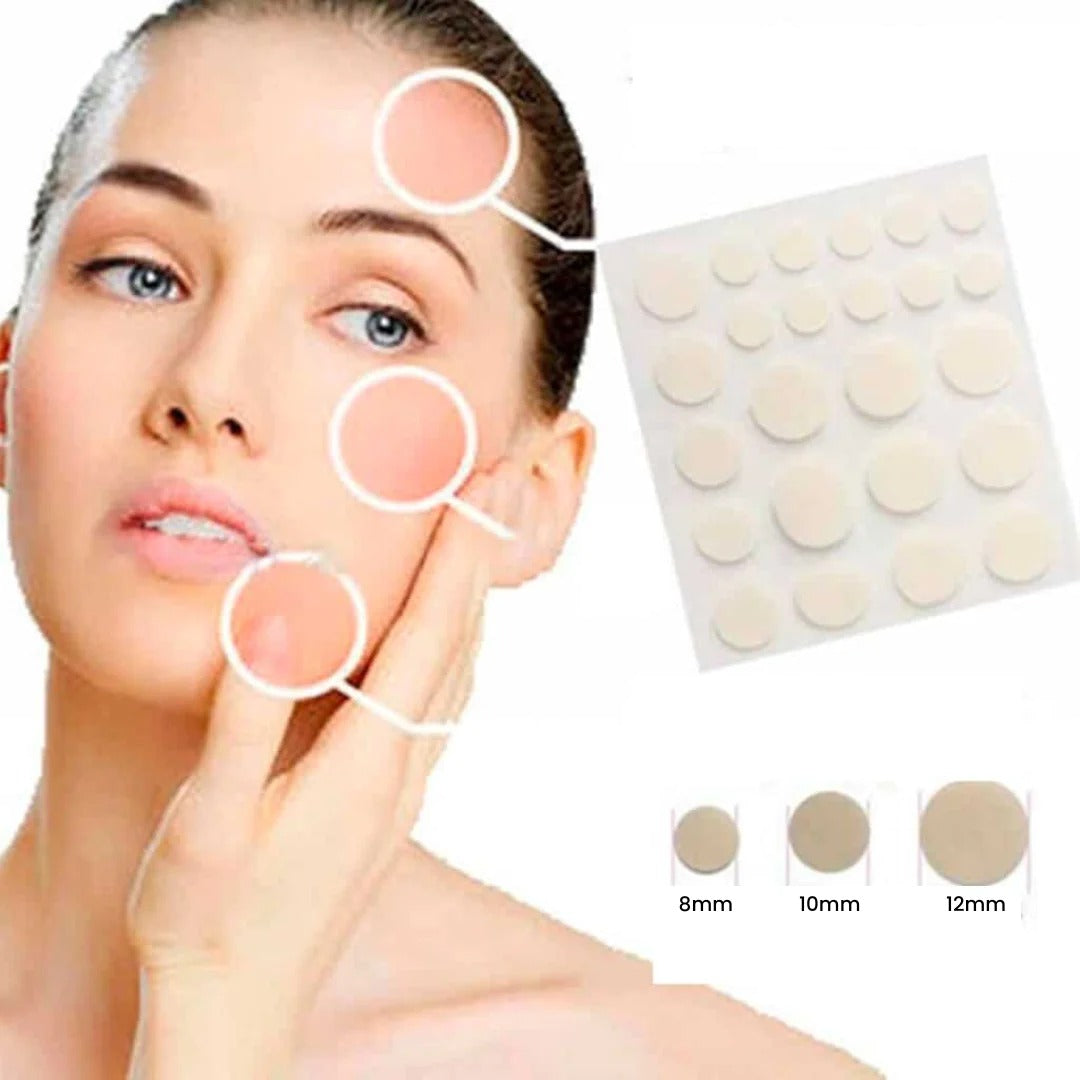 24 Patches To Eliminate Acne 