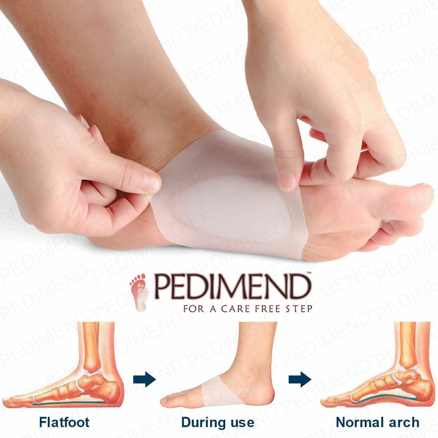 Silicone Arch Support Insole + Free Shipping 