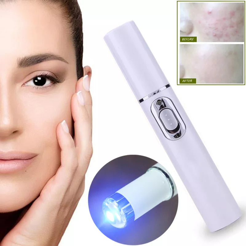 Electric Laser Acne Removal Machine