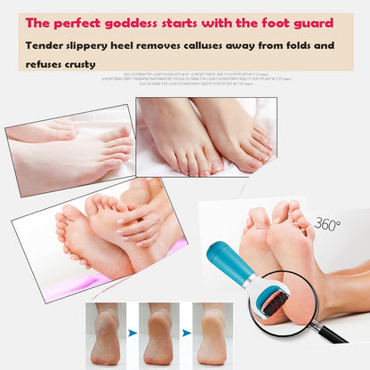 Electric Callus Remover UBS Exfoliator + Free Shipping